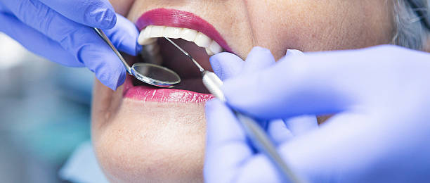 Best Urgent Care for Lost Fillings or Crowns in Sloan, IA